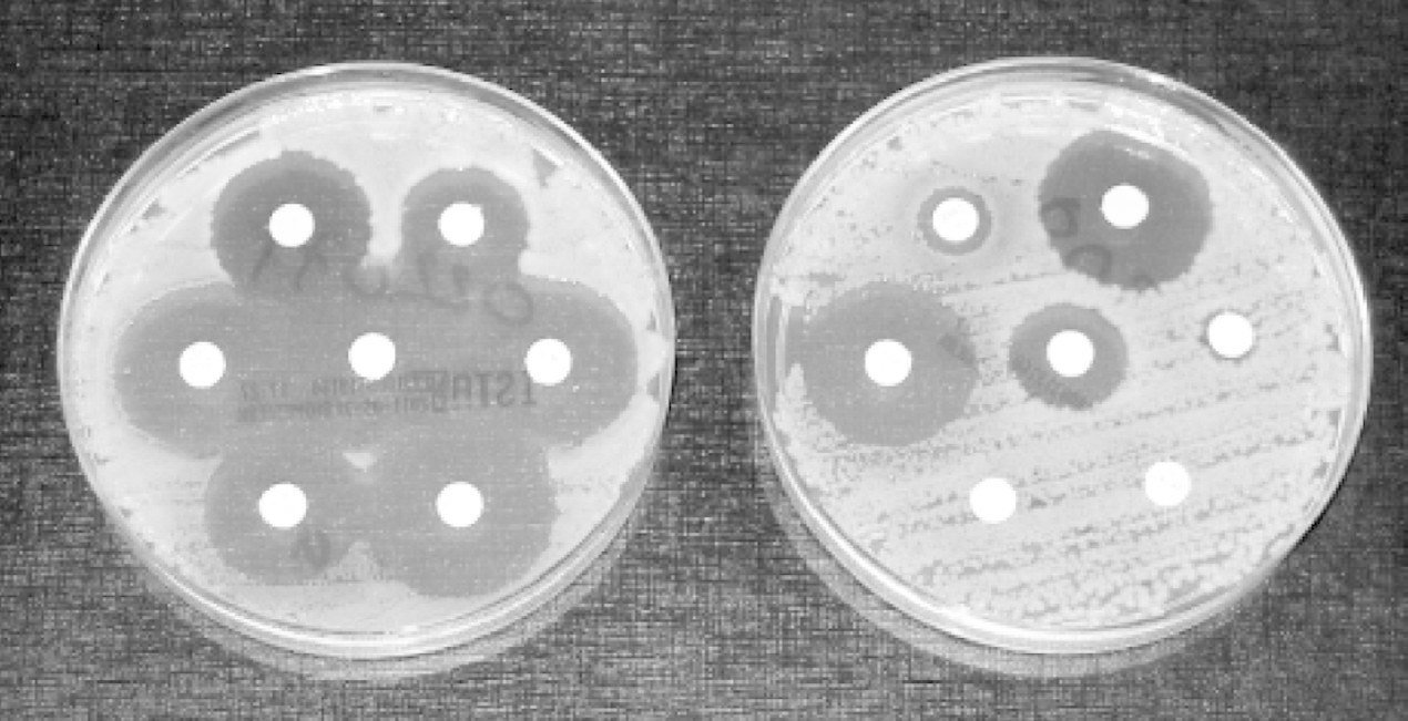Antibióticos: a última linha de defesa está em risco